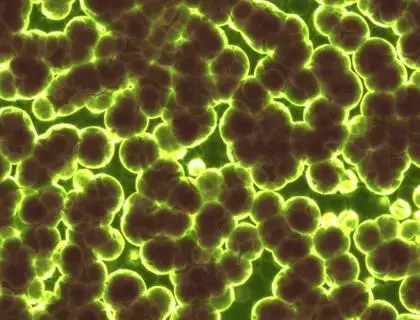 microbes